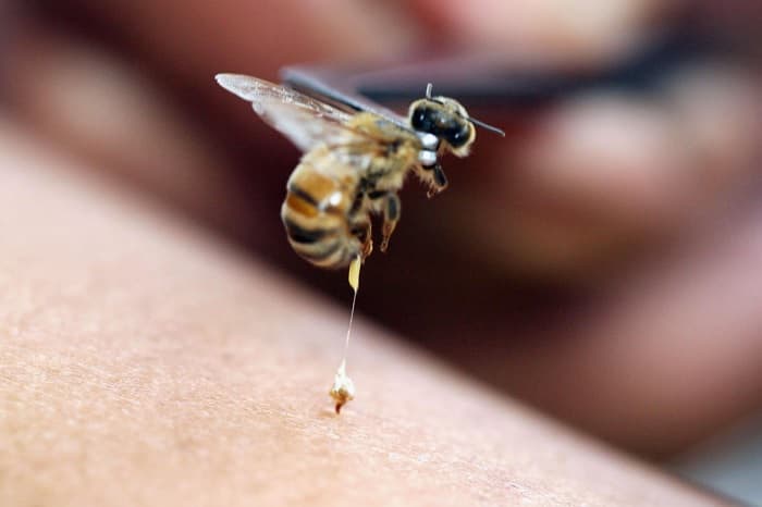 کاربردهای دارویی زهر زنبور عسل